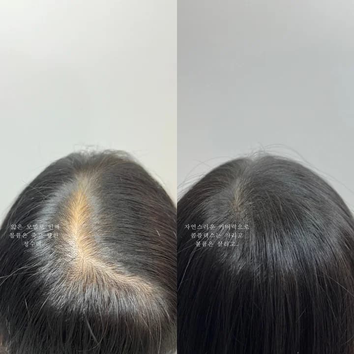 리멤버스칼프SMP