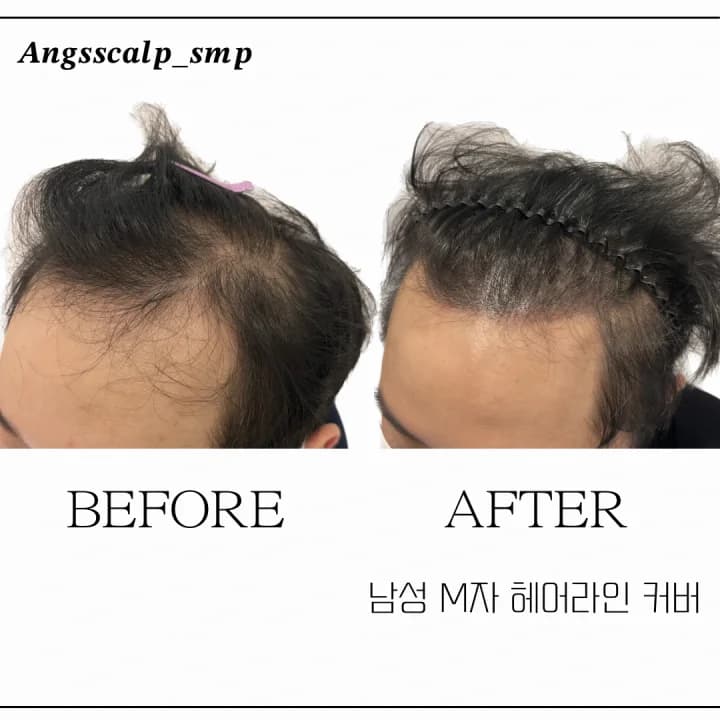 룡스뷰티(앙스스칼프)