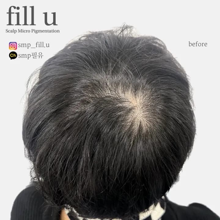 ๋จ์ฑ ์ ์๋ฆฌ ๋ํผ๋ฌธ์ SMP