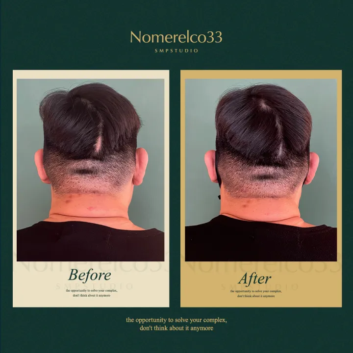 ํํฐ ์ปค๋ฒ