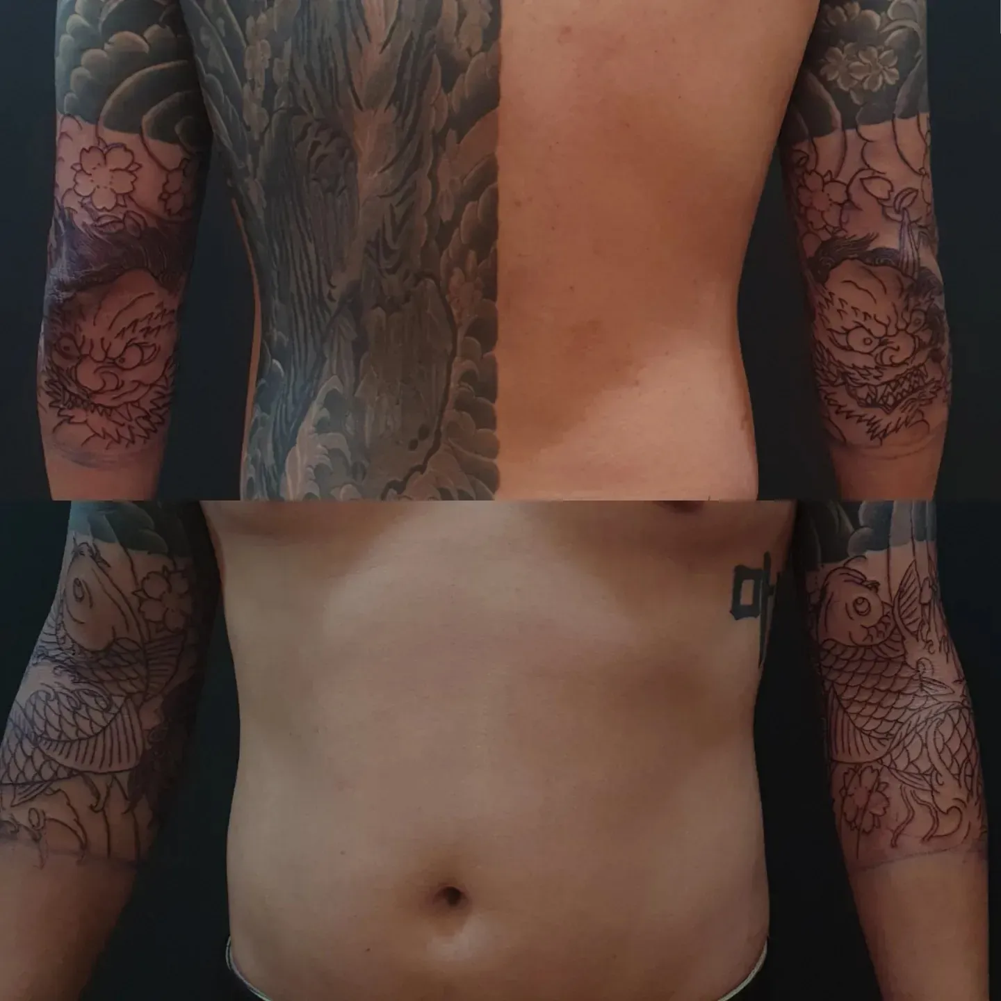 ์ฐ์ฅํํฌ ๋ผ์ธ์์
์
๋๋ค. ๋ชฉํฌํํฌ TSํํฌ - 1