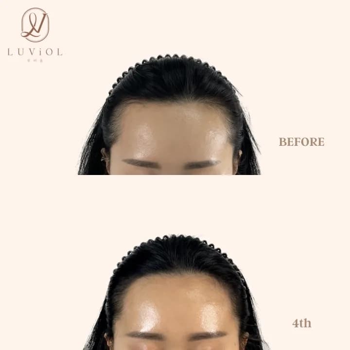 ํค์ด๋ผ์ธ ๋ฐ์๊ตฌ+์์ฒญ์ ์์ฑsv (์นดํก ํ์น ์ถ๊ฐ ์40%)