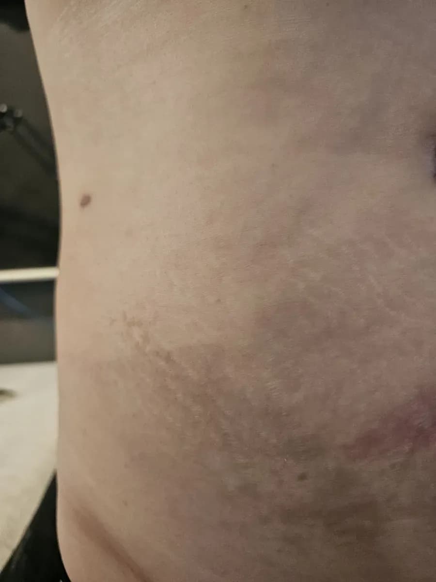 ํผ์ด ์ฅ๋ฏธ ์ปค๋ฒ์
ํํฌ - 1