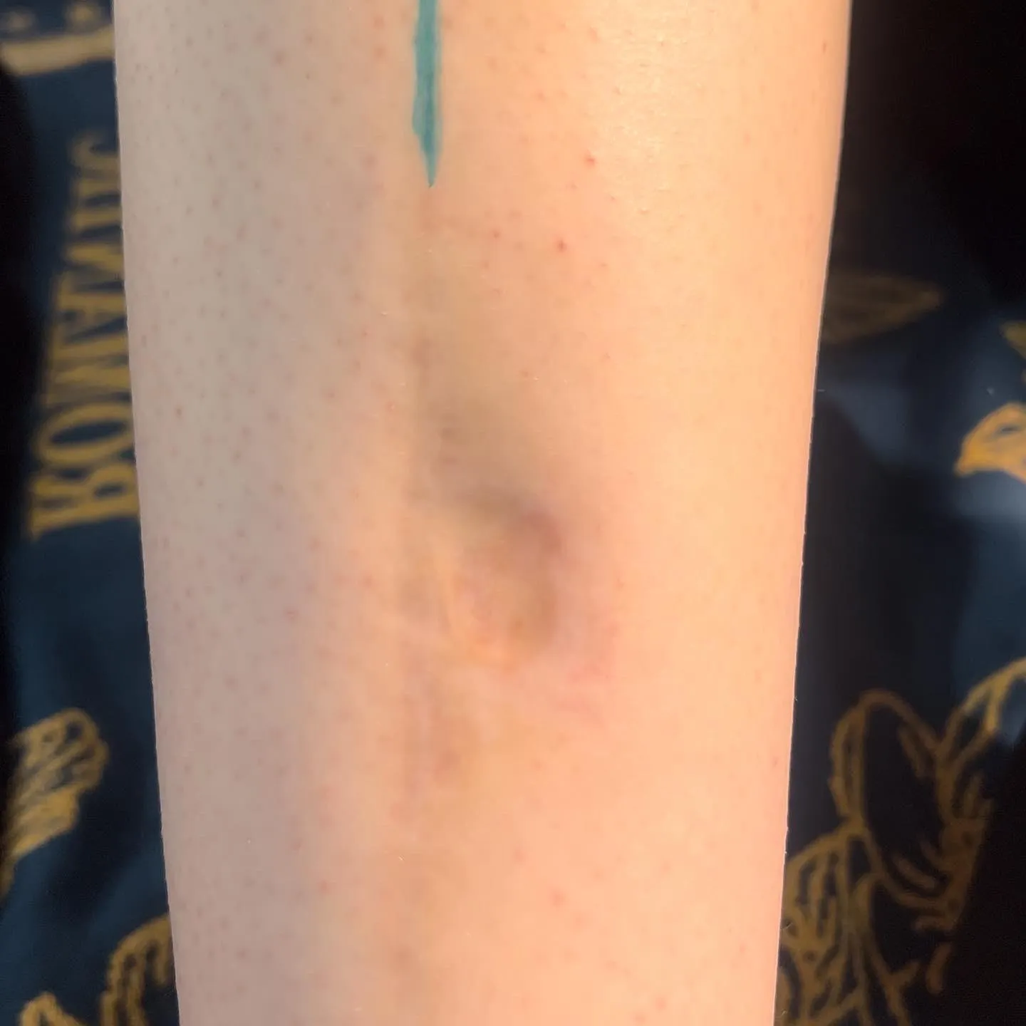 울산타투 커버업타투