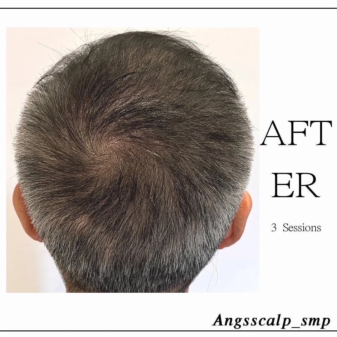 smp๋ํผ๋ฌธ์