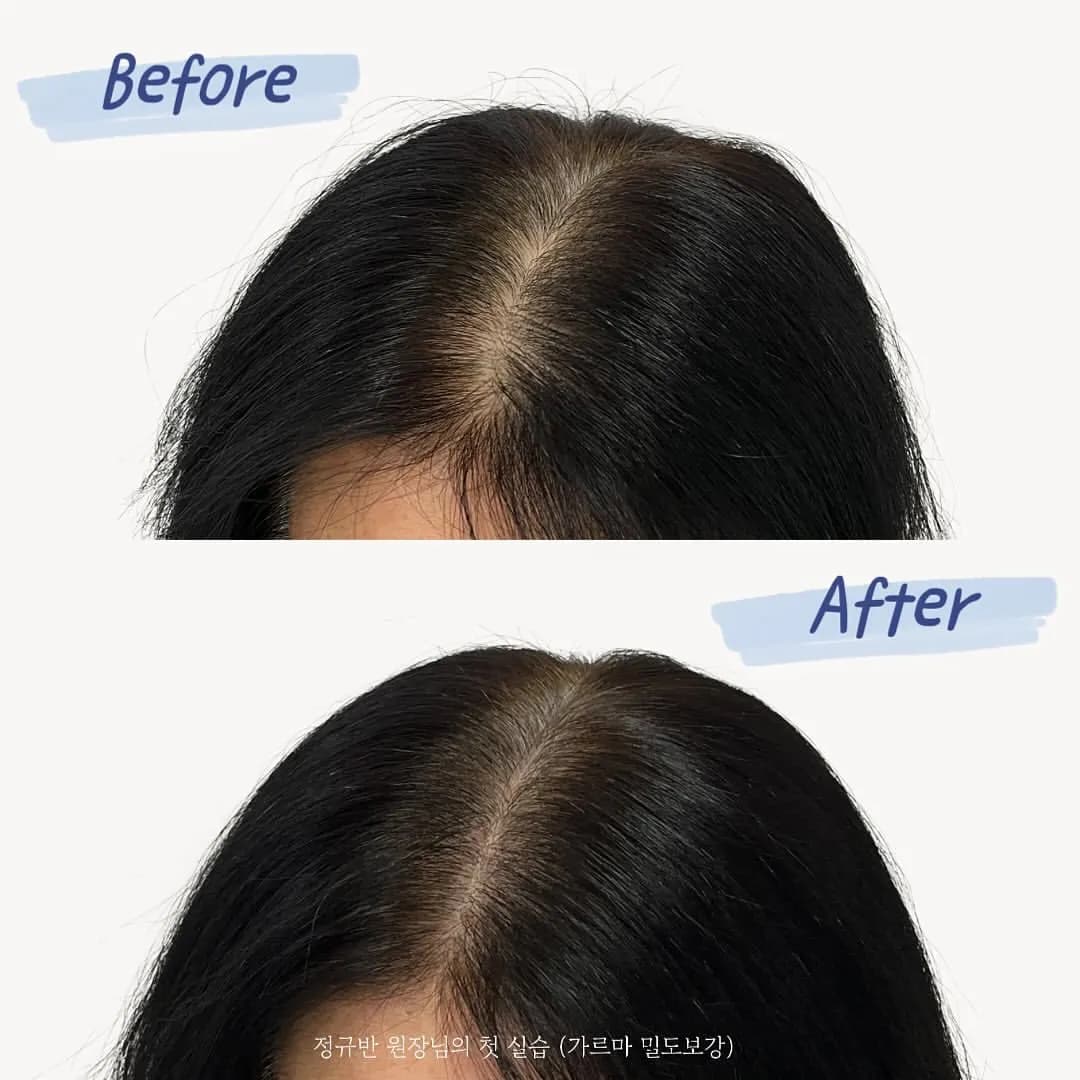 ๊ฐ๋ฅด๋ง ํ๋ชจ