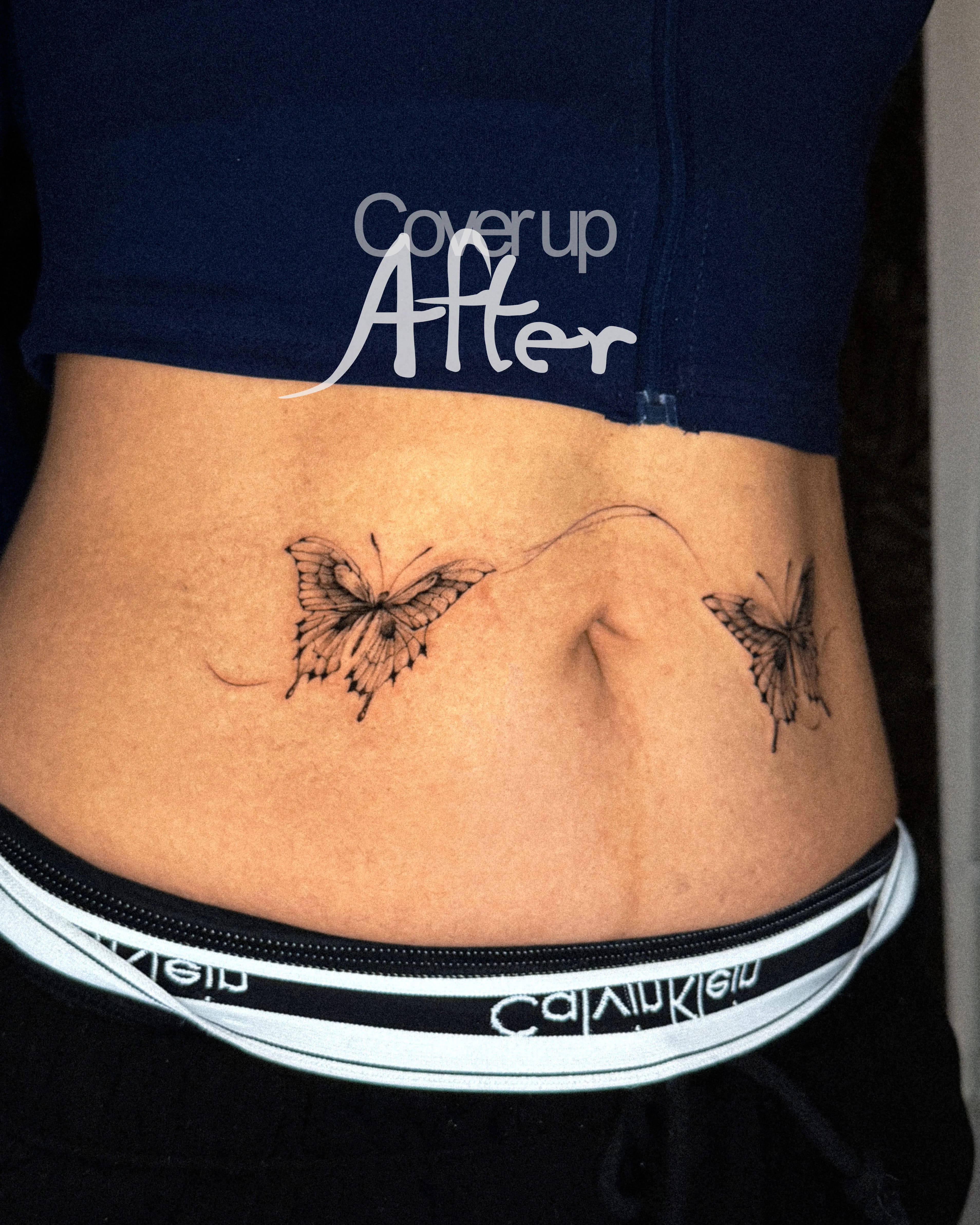 흉터 커버업, 나비와 흐름