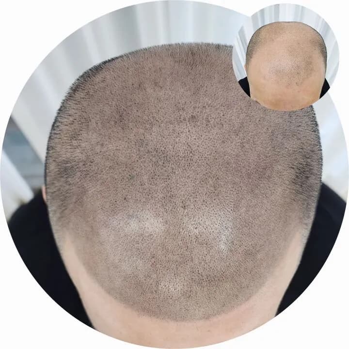 ์ญ๋ฐ๋์์ธsmp