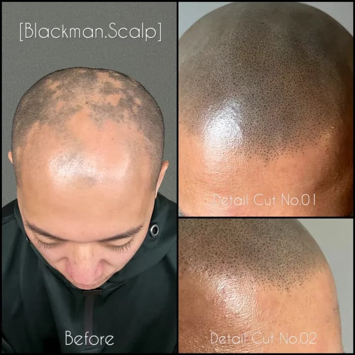 ์ํํ๋ชจ์ปค๋ฒ ์ญ๋ฐ ๋ํผ๋ฌธ์