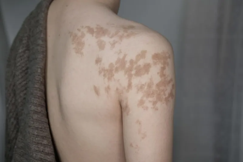 반점 커버업 ( 달 & 흐름 ) - 1