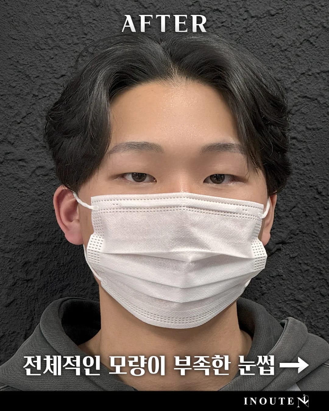 브로우 컨설팅(B/A)