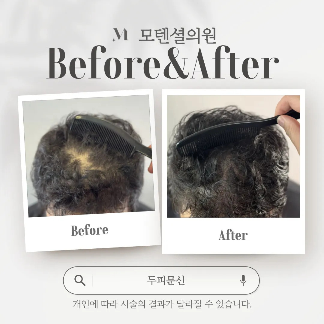 ๋จ์ ๋ํผ๋ฌธ์