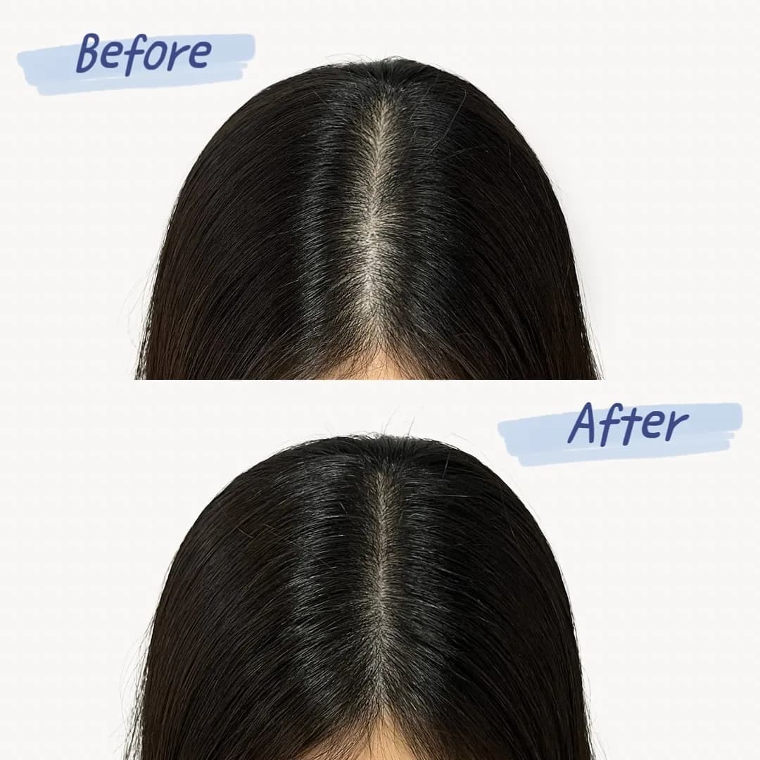 ๊ฐ๋ฅด๋ง ๋ฐ๋ ๋ณด๊ฐ