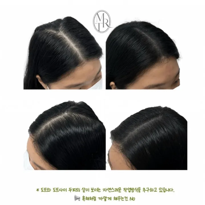 여성 가르마 커버