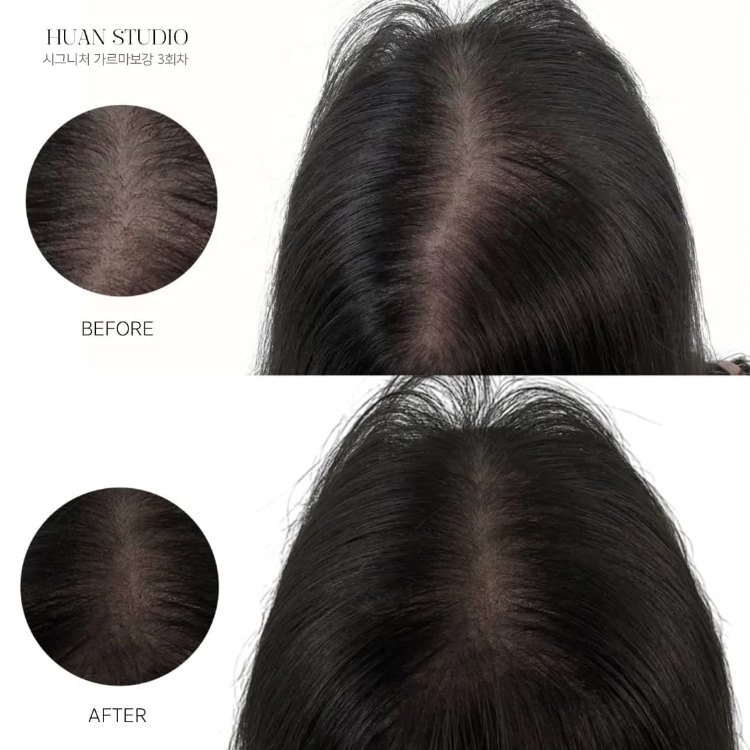 smp 여성 가르마 정수리| MZ샷에서 살아남기 - 1