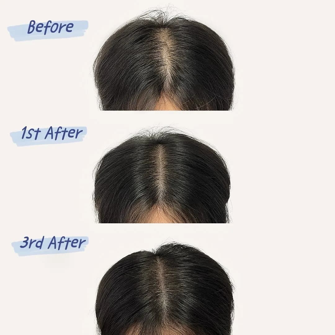 ๊ฐ๋ฅด๋ง ํ๋ชจ