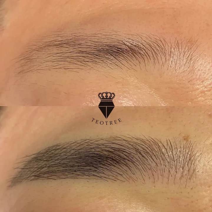 무보정 테오트리 기본패턴