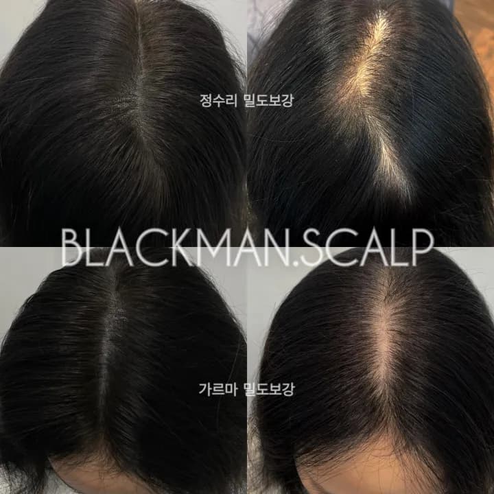 가르마 정수리 두피문신