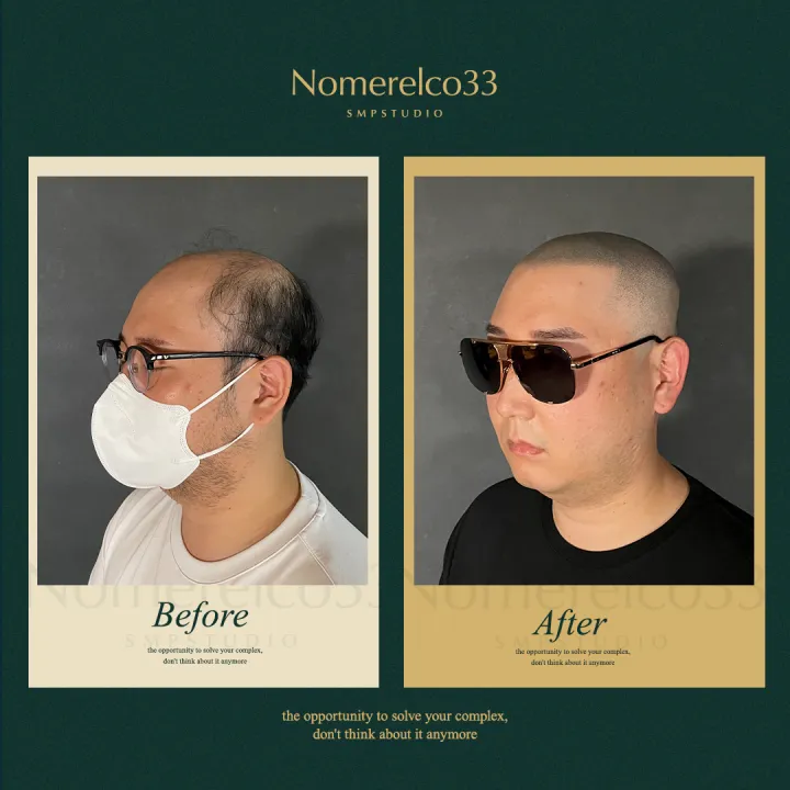 ์ญ๋ฐ ๋ฌธ์ (BSMP)