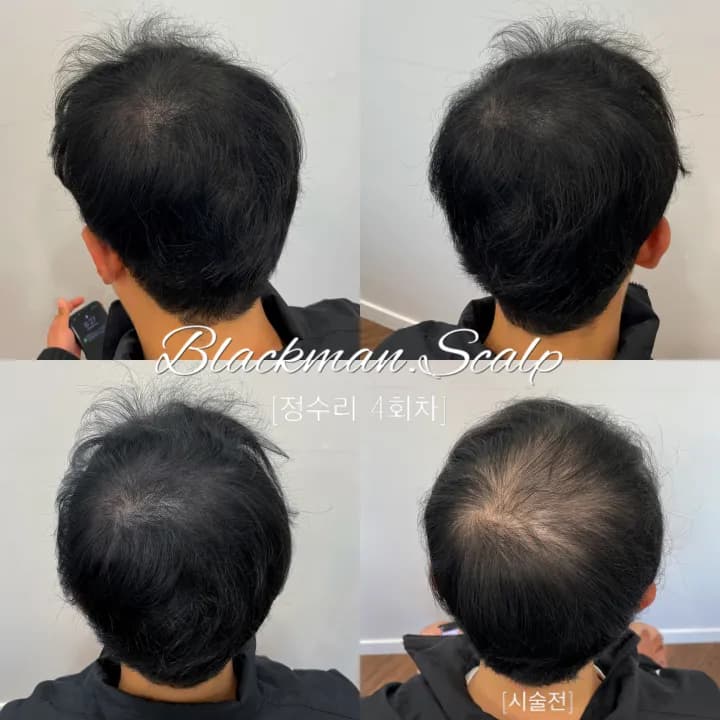 ์ ์๋ฆฌ ๊ฐ๋ฅด๋ง ๋ํผ๋ฌธ์