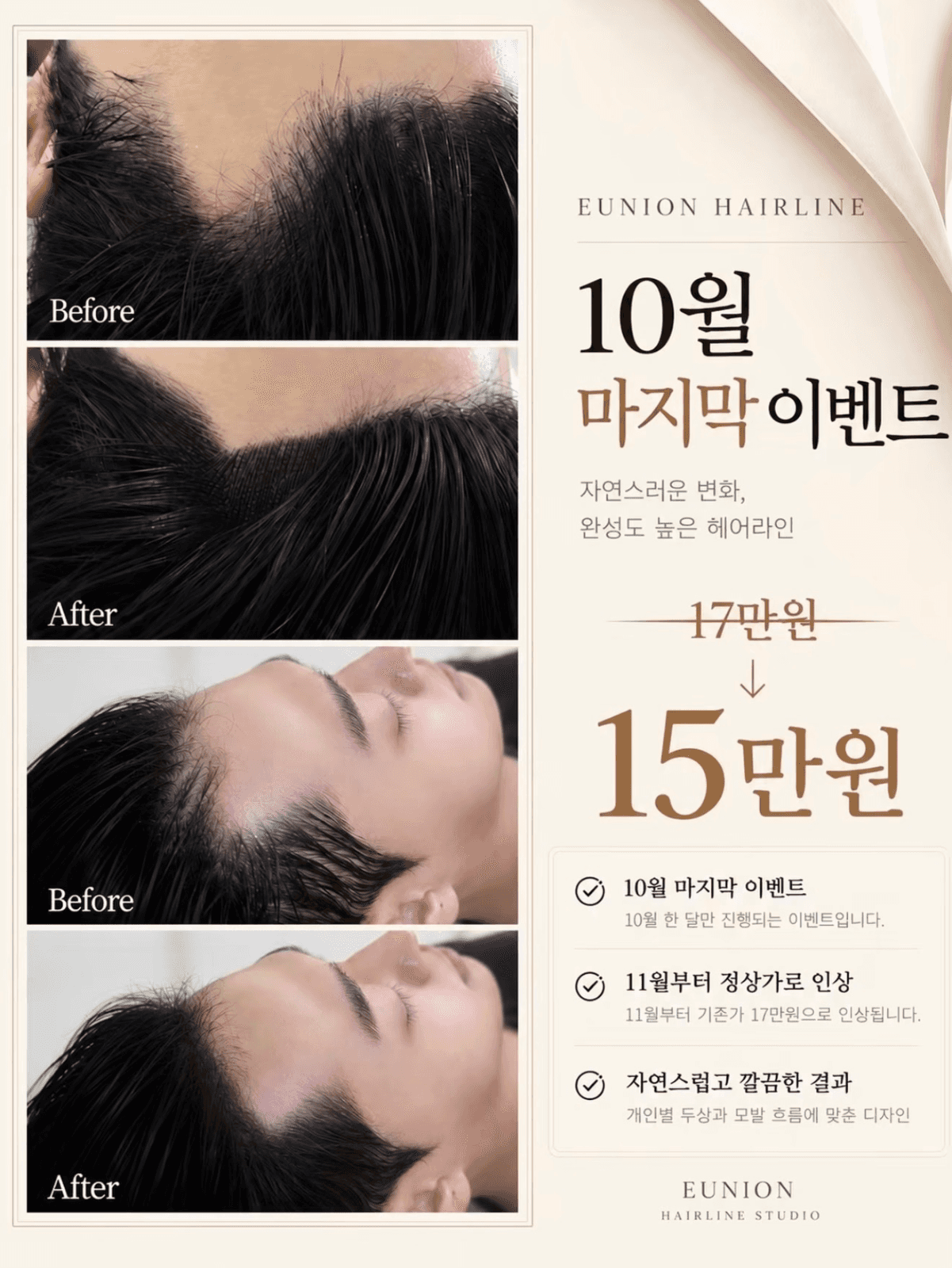 10월 마지막 이벤트|헤어라인 결기법 15만원
