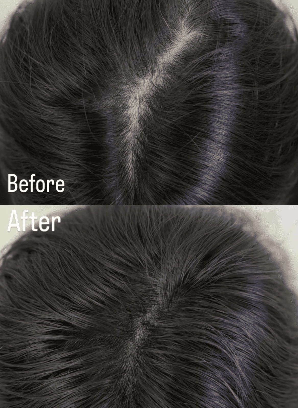 넓어진 가르마·정수리, 자연스럽게 커버한 Before & After