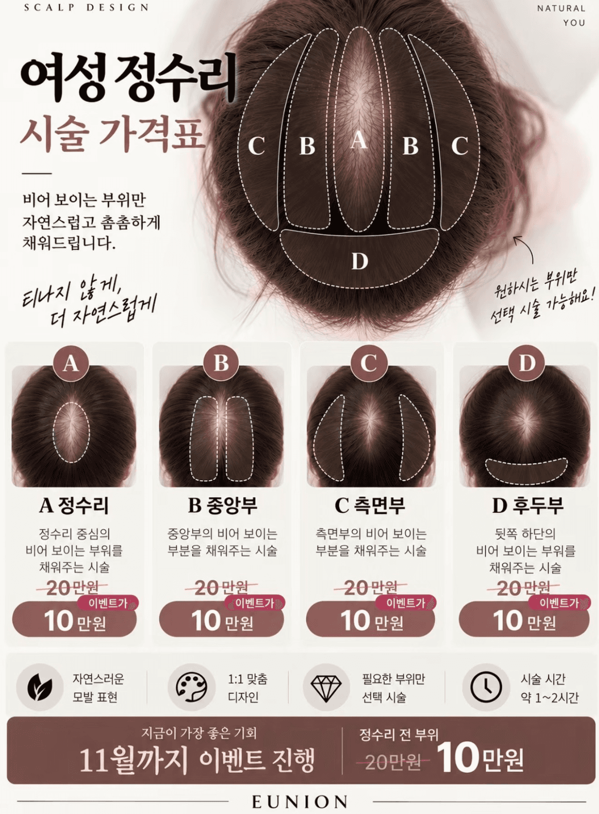 여성 정수리 고민, 비어 보이는 부위만 자연스럽게!