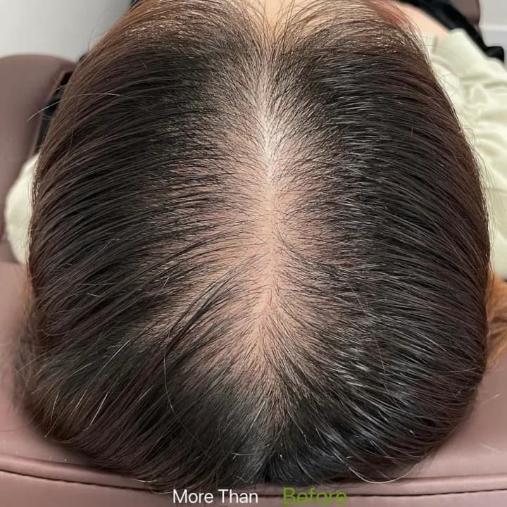 여성 가르마 커버