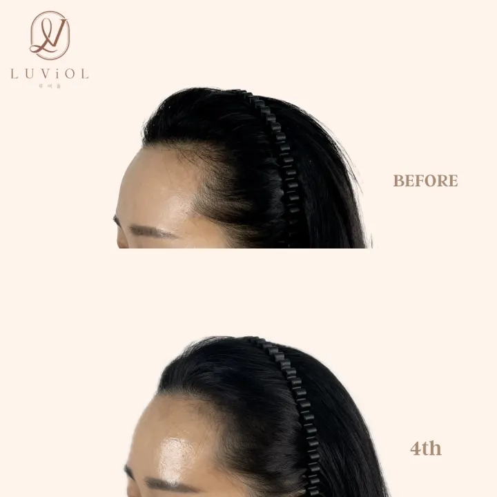 ํค์ด๋ผ์ธ ๋ฐ์๊ตฌ+์์ฒญ์ ์์ฑsv (์นดํก ํ์น ์ถ๊ฐ ์40%)