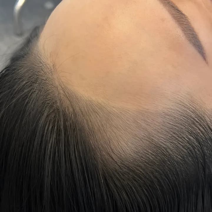 여성 결 헤어라인