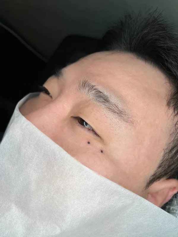 남자눈밑점